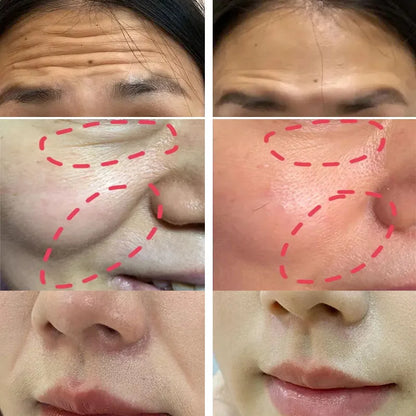 Baume multi-rebond pour l'élimination instantanée des rides, collagène, Anti-âge, peau ferme, estompe les ridules, crème de soin hydratante éclaircissante et terne